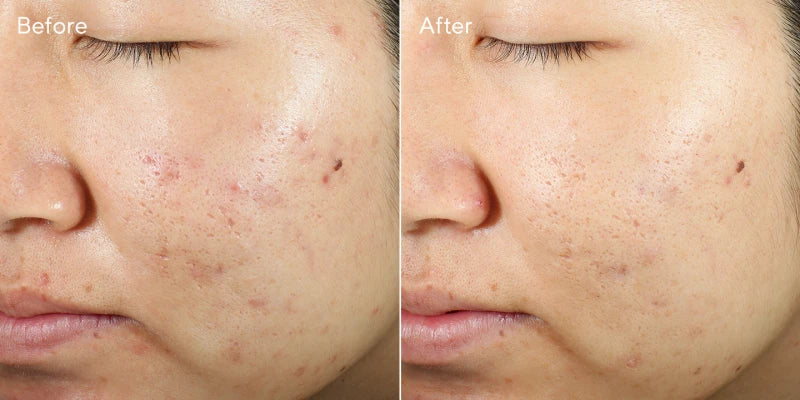 10925-before-after-3