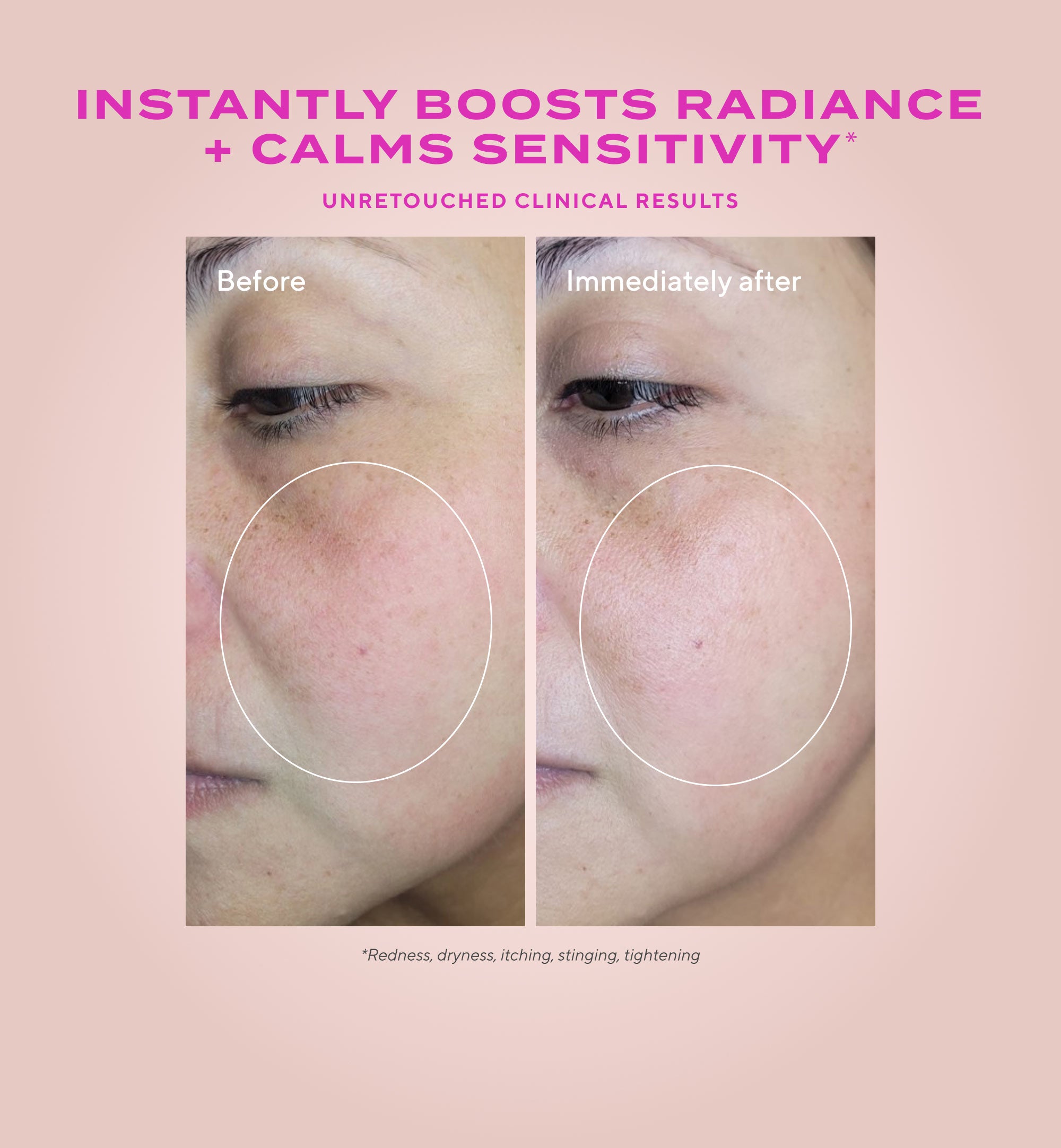 Gentle Glycolic Acid Resurfacing Serum for Sensitive Skin