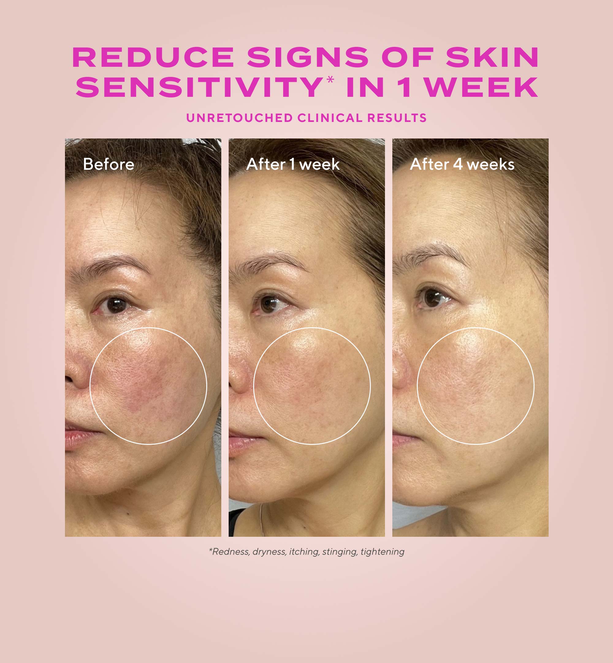 Gentle Glycolic Acid Resurfacing Serum for Sensitive Skin