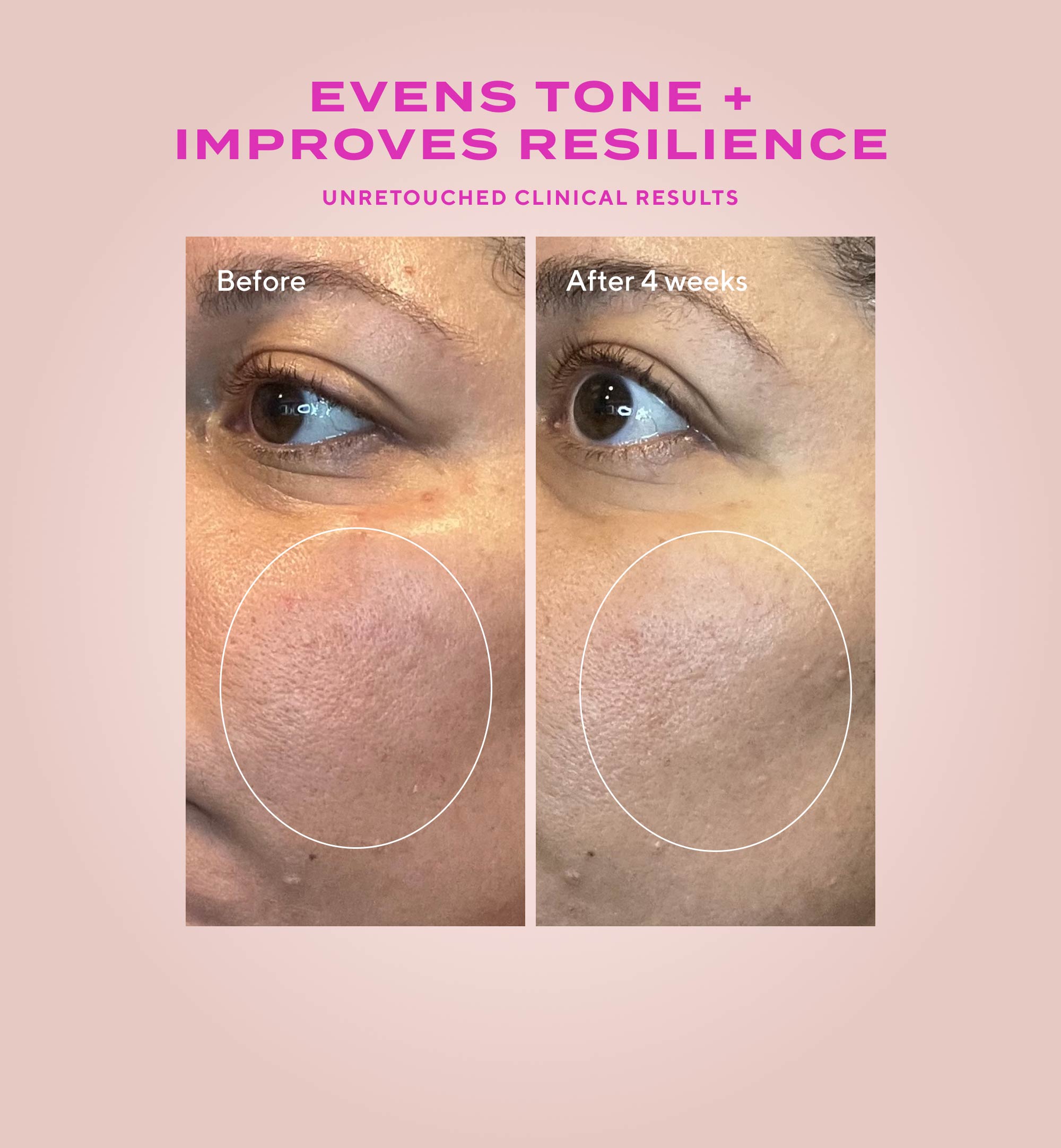 Gentle Glycolic Acid Resurfacing Serum for Sensitive Skin