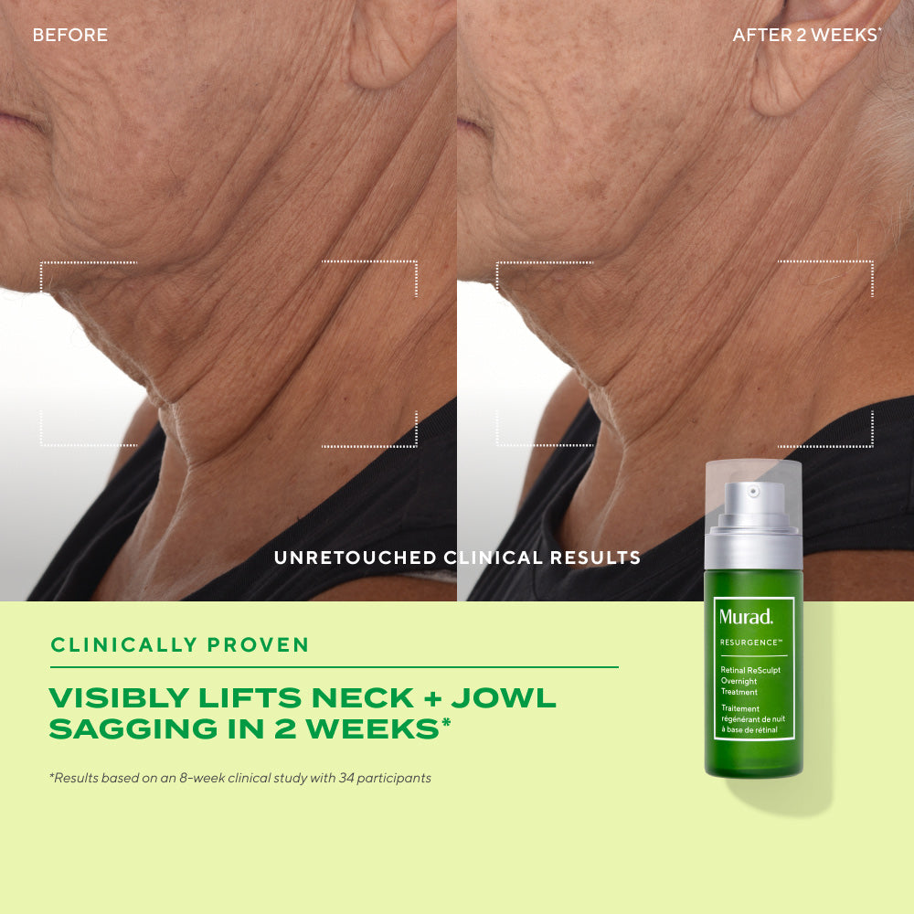 Retinal ReSculpt Overnight Treatment