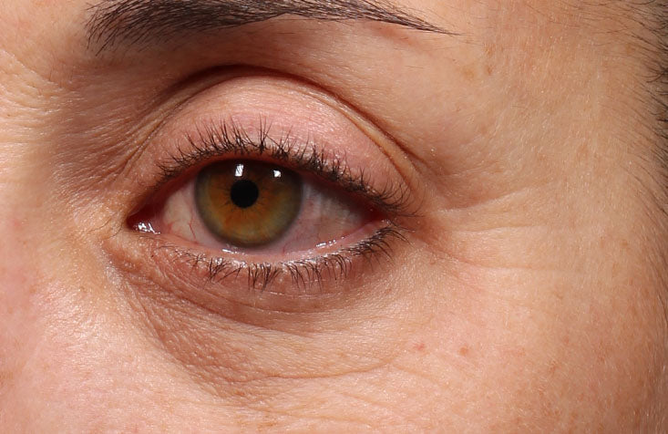 Retinol_Youth_Renewal_Eye_Serum_After_733x476_1