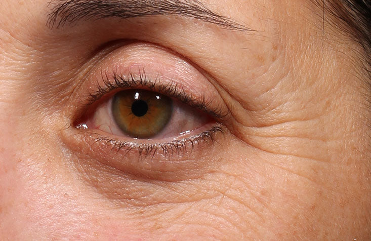 Retinol_Youth_Renewal_Eye_Serum_Before_733x476_1