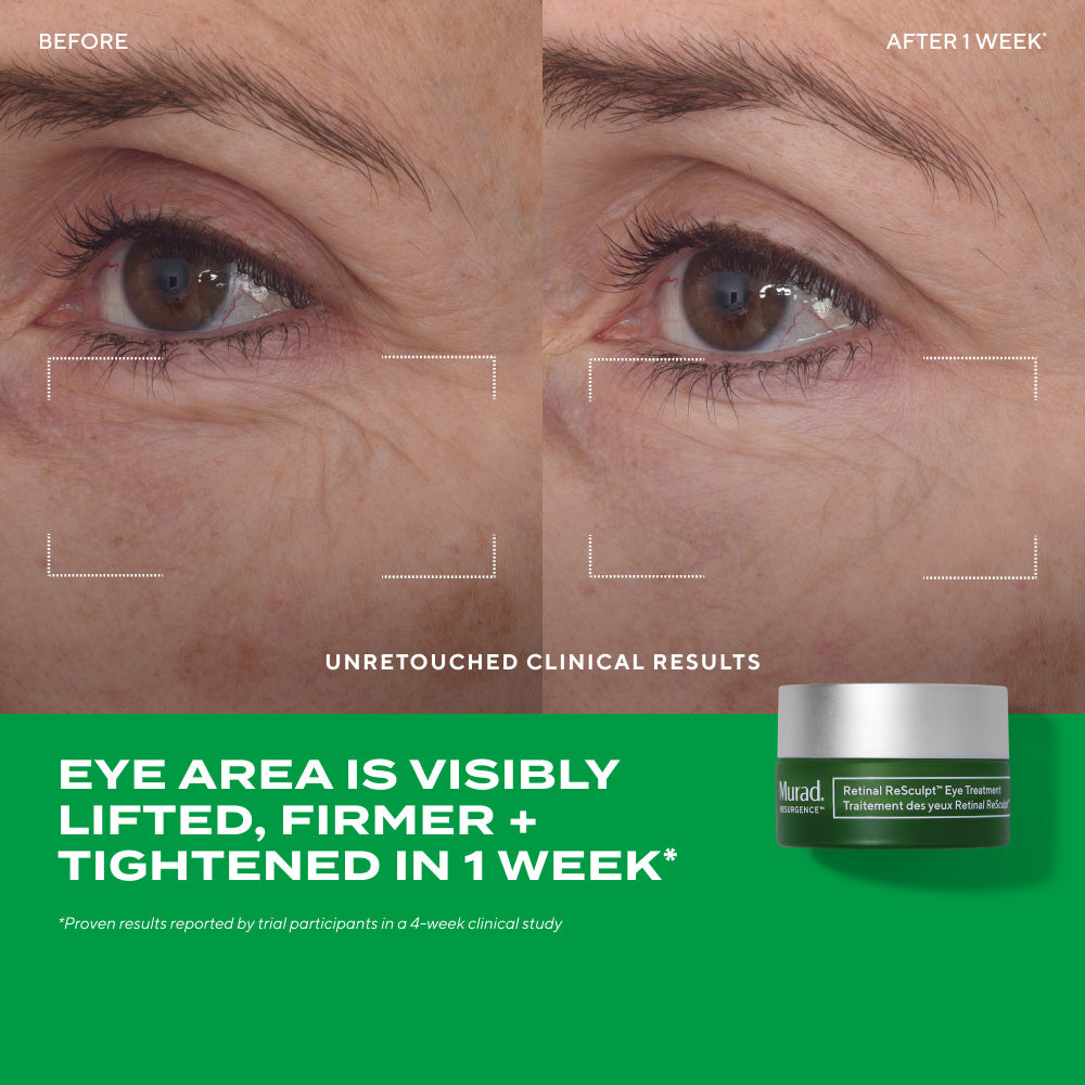Traitement de lifting des yeux Retinal ReSculpt