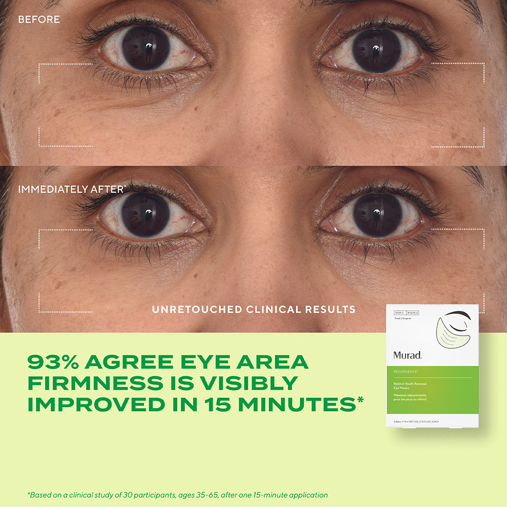 Masques pour les yeux régénérateurs de jeunesse Dr. Zion x Murad au rétinol