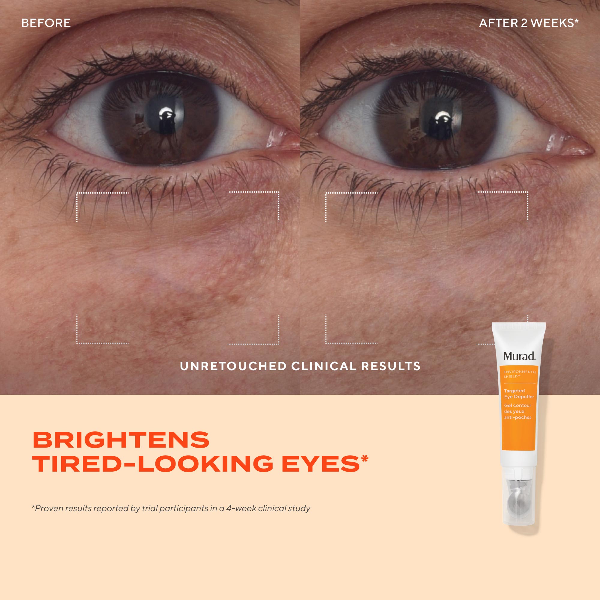 Depuffer oculaire ciblé