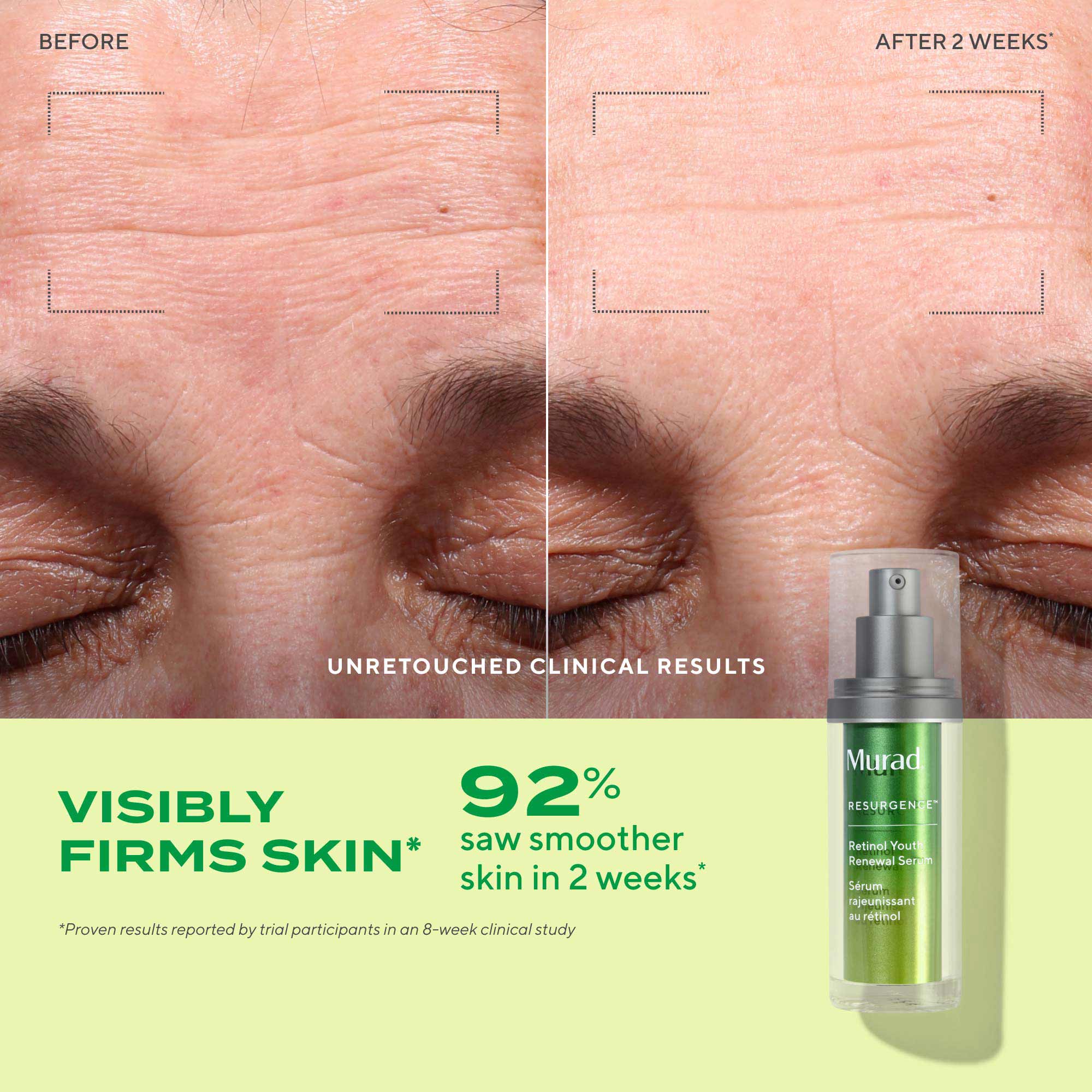 Sérum Rénovateur Jeunesse au Rétinol