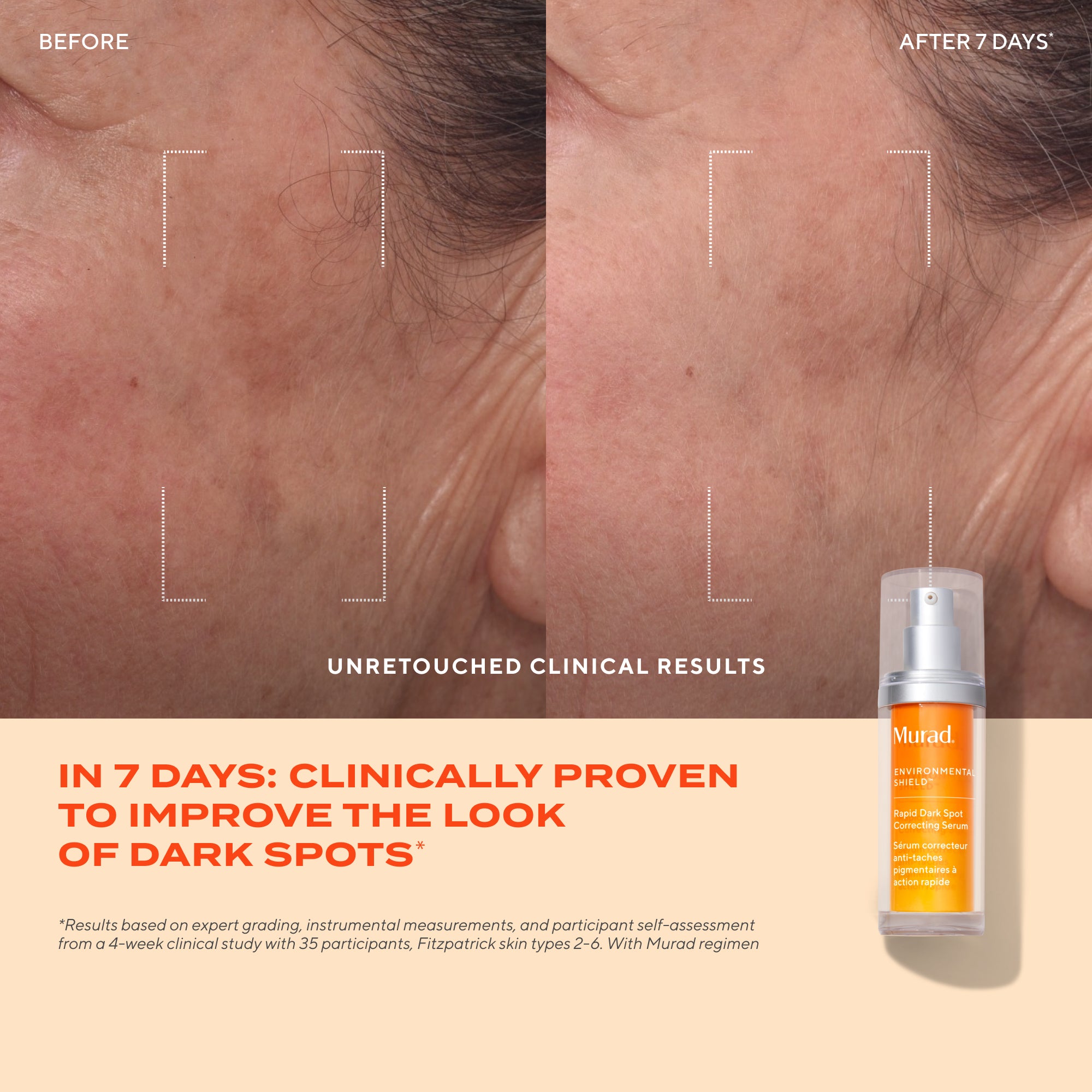 Rapid Dark Spot Correcting Serum