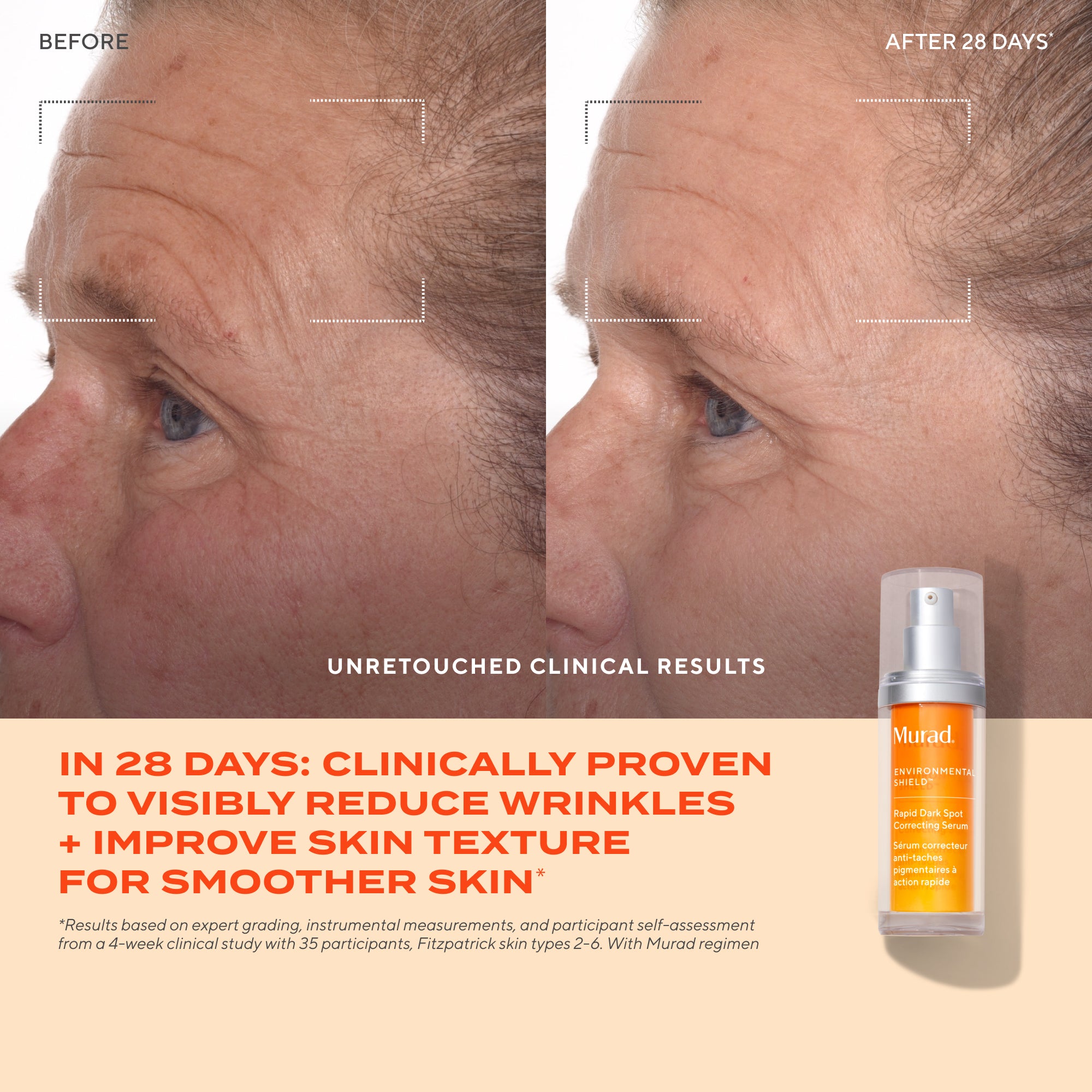 Rapid Dark Spot Correcting Serum