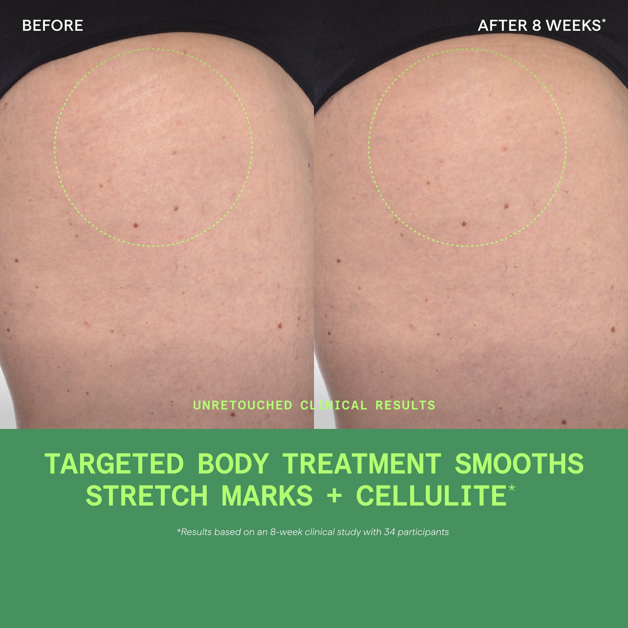 Retinal ReSculpt Body Treatment