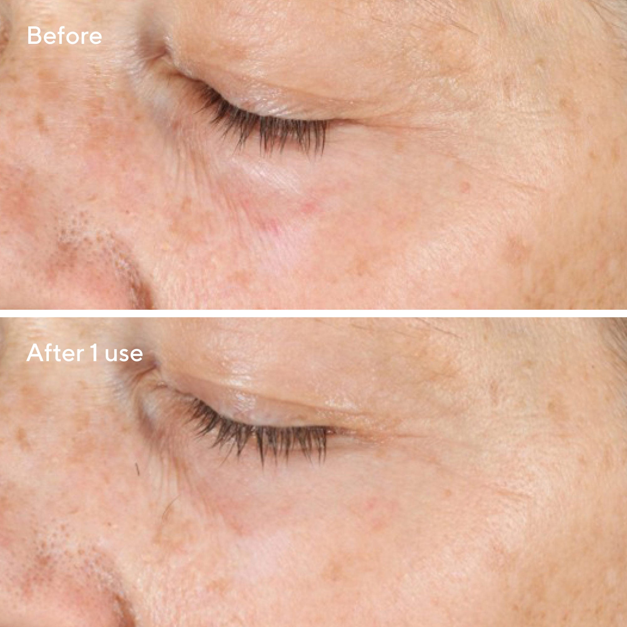 Soin du visage triple exfoliant Vita-C 