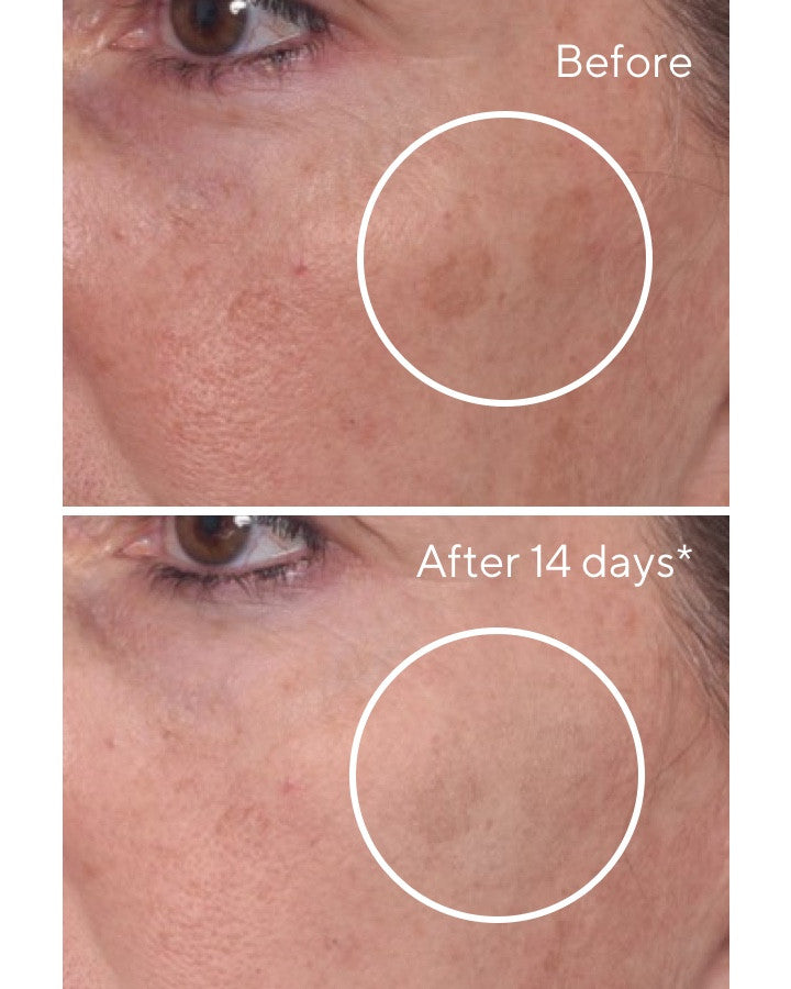 Rapid Dark Spot Correcting Serum Before and After Comparison 4