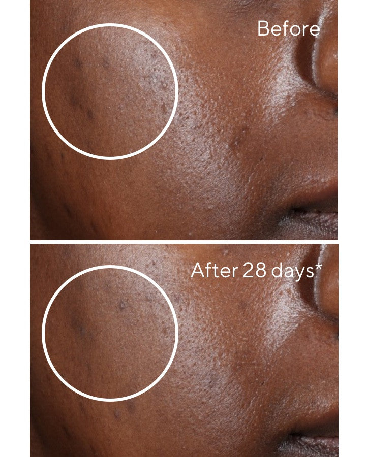 Rapid Dark Spot Correcting Serum Before and After Comparison 5