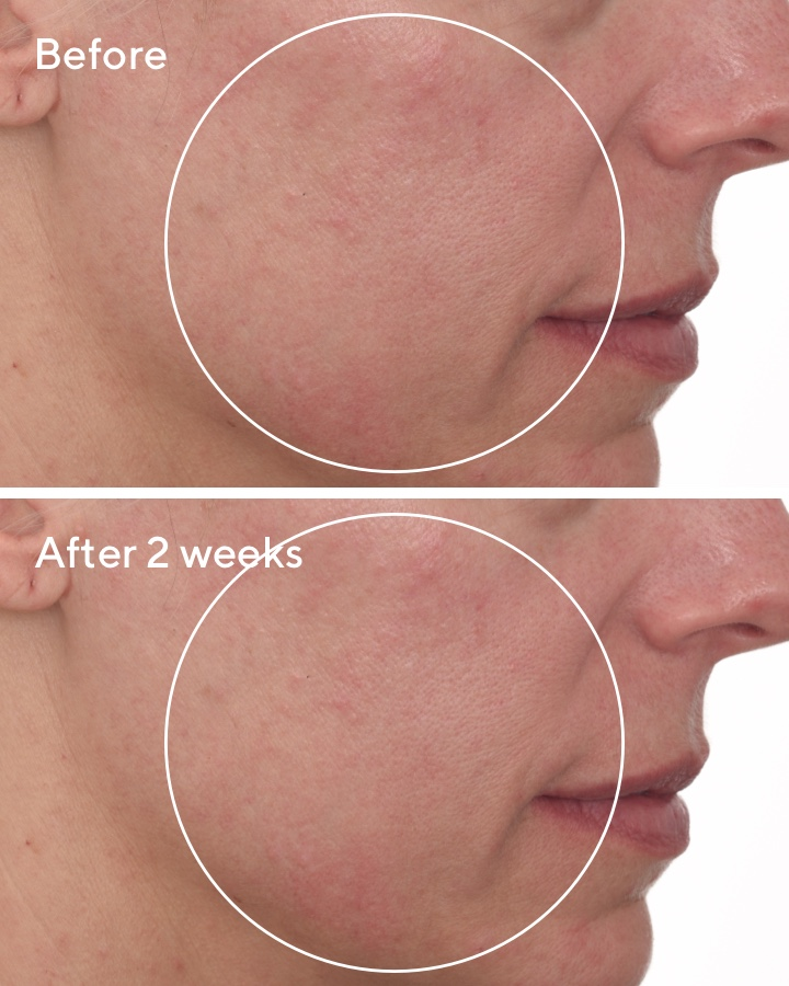 Cellular Hydration Barrier Repair Cream B&A