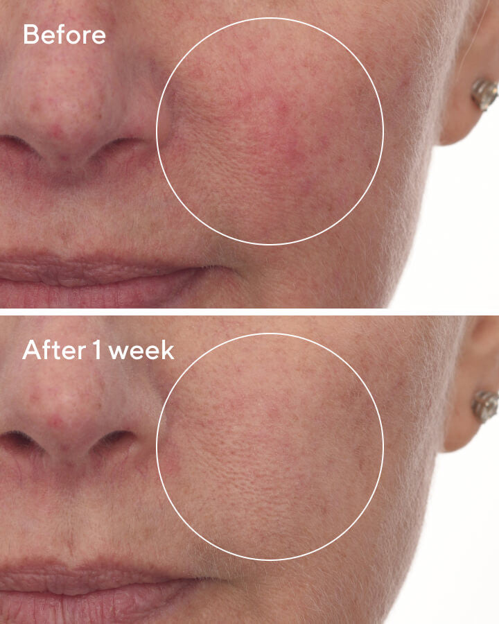 Cellular Hydration Barrier Repair Serum - B&A